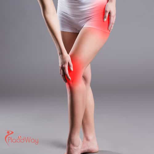 Stem Cell Therapy for Arthritis in Thailand: Cutting-Edge Treatment Options for Australian Patients